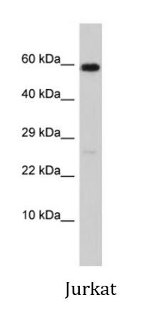 Anti-MMP17 / MT4-MMP