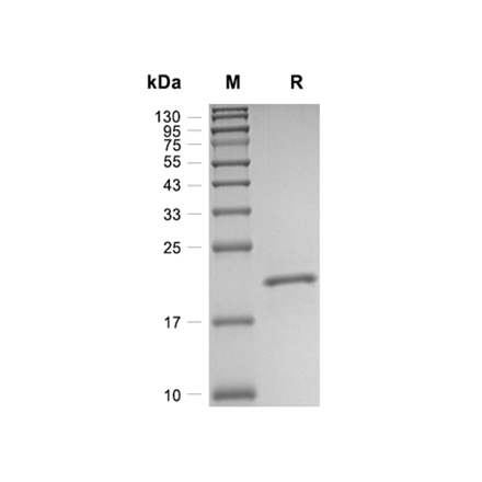 Keratinocyte Growth Factor (KGF) Recombinant (Human)