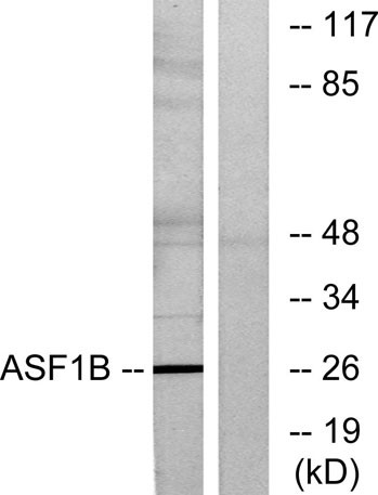Anti-ASF1B