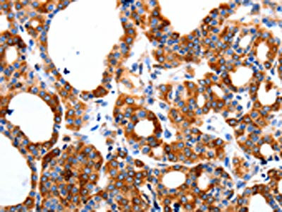 Anti-HCN1