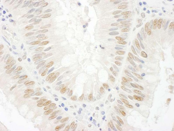 Anti-BCCIP (IHC)