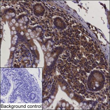 Anti-Hsc70 Interacting Protein HIP