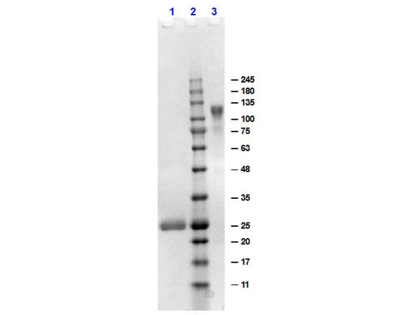 Anti-Human IgG F(ab')2 [Goat] (Min X Bv Hs Ms Rb Rt &amp; Sh serum proteins) F(ab')2 fragment