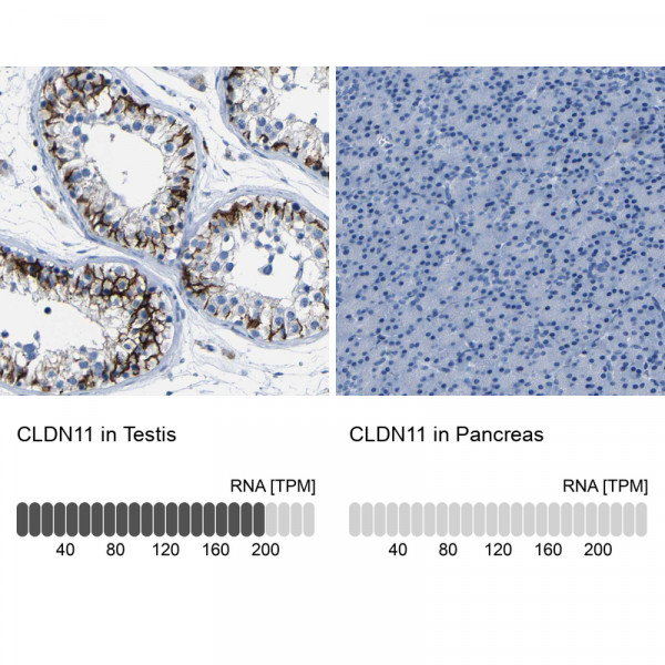 Anti-CLDN11