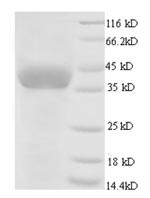 Glyceraldehyde-3-phosphate dehydrogenase (GAPDH), chicken, recombinant