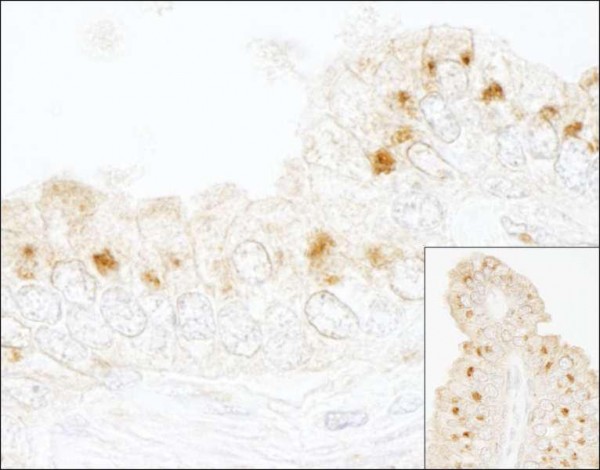 Anti-GBF1 (IHC)