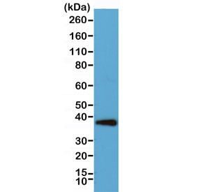 Anti-Synaptophysin, clone RM258 (recombinant antibody)
