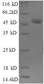 Ubiquitin thioesterase OTUB1 (OTUB1), partial, recombinant human