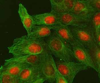 Anti-MACROH2A2 / H2AFY2