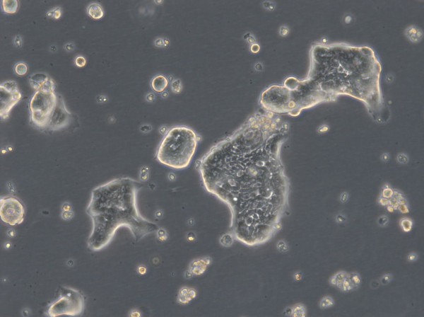 HROC32 Cells