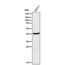 Anti-CTSH / Cathepsin H, clone 31C05