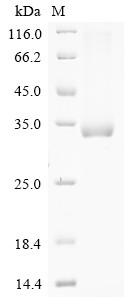 Collagen alpha-3 (IV) chain (Col4a3), partial, mouse, recombinant