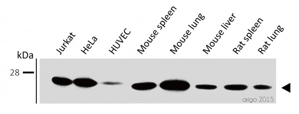 Anti-HMGB1