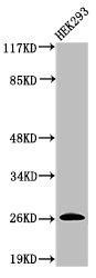 Anti-Cleaved-C1R (I464)