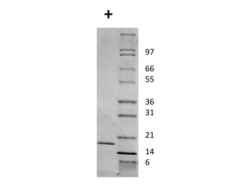 Interleukin-2