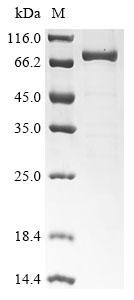 High affinity cGMP-specific 3&#039;,5&#039;-cyclic phosphodiesterase 9A (PDE9A), human, recombinant