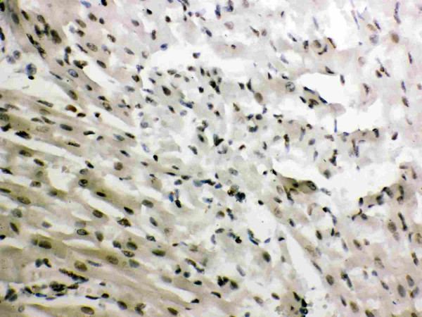 Anti-Glucocorticoid Receptor