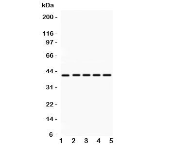 Anti-HOXA10