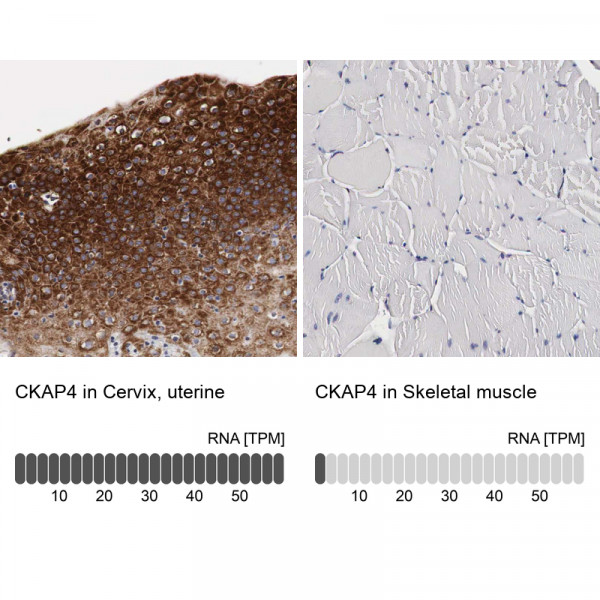 Anti-CKAP4