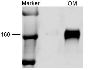 Anti-SLC12A1 / NKCC2