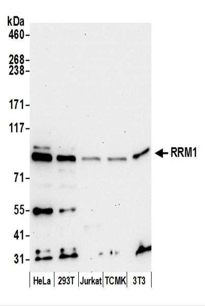 Anti-RRM1