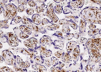 Anti-FOLR2 Monoclonal Recombinant Antibody