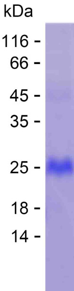 Recombinant Human ADAMTS19 Protein