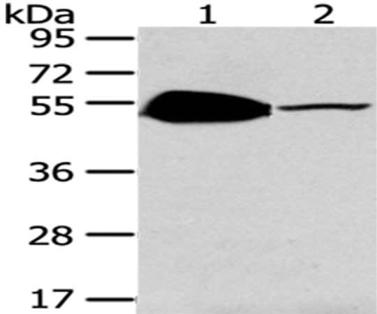 Anti-TSPYL1
