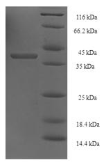 DNA repair and recombination protein RAD52 (RAD52), partial, Saccharomyces cerevisiae, recombinant