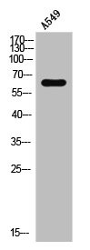 Anti-DPYSL2