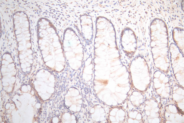 Anti-UBE2C Recombinant Monoclonal, clone 22E1