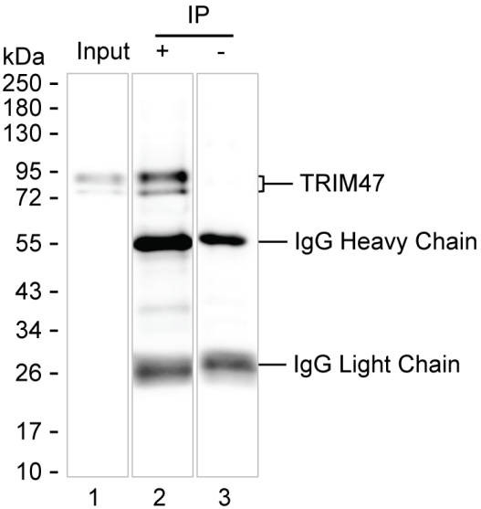 Anti-TRIM47 Magnetic Beads