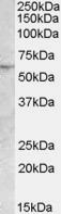 Anti-PNPLA2 / Desnutrin, Internal