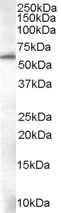 Anti-58KGolgi protein(Internal)/FTCD, Internal