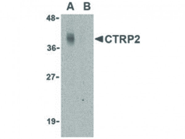 Anti-CTRP2