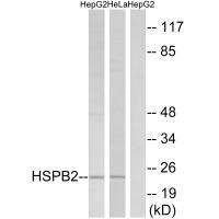 Anti-HSPB2