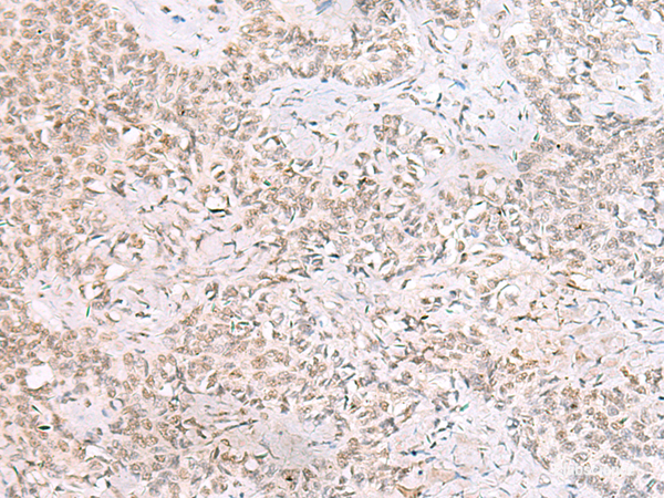Anti-SMNDC1