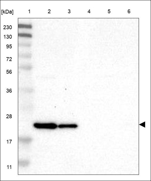 Anti-CLDN8