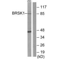 Anti-BRSK1