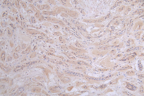 Anti-PRKAR2A Recombinant Monoclonal, clone 15G8