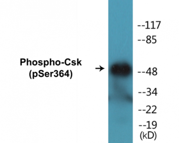 Csk (Phospho-Ser364) Colorimetric Cell-Based ELISA Kit