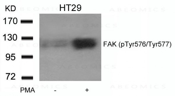 Anti-FAK (phospho-Tyr576/Tyr577)
