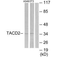 Anti-TACSTD2
