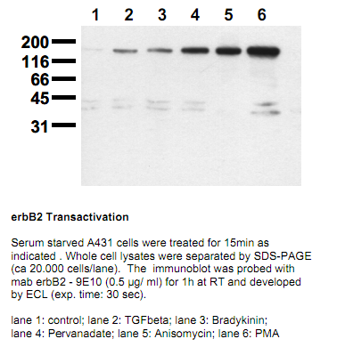 Anti-phospho-ErbB2 (Ser1113), clone 9E10