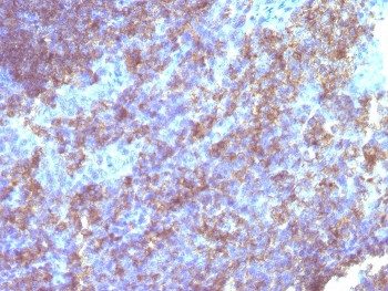 Anti-CD45 (Leukocyte marker), clone Bra55