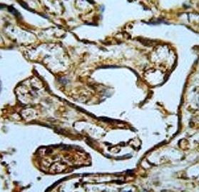 Anti-MPP1
