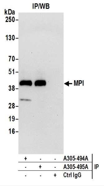 Anti-MPI