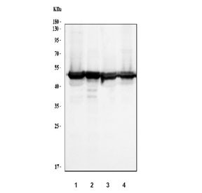 Anti-RCC1 / Regulator of Chromosome Condensation, clone 7B5D2