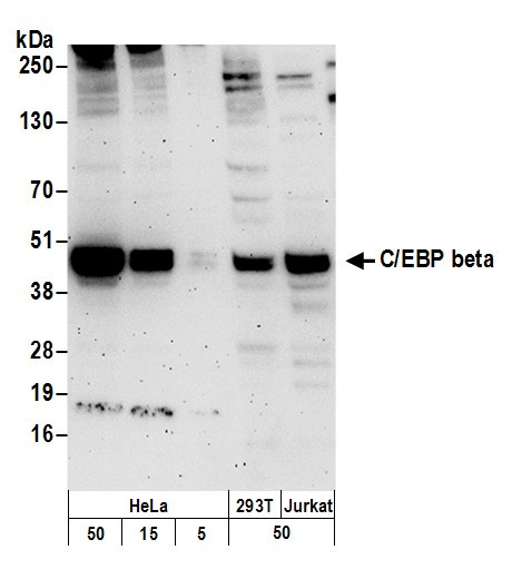 Anti-C/EBP beta