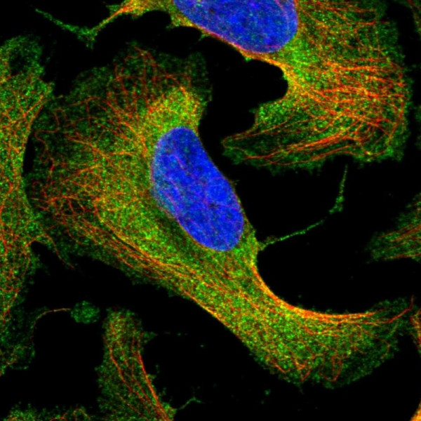 Anti-PSMC5